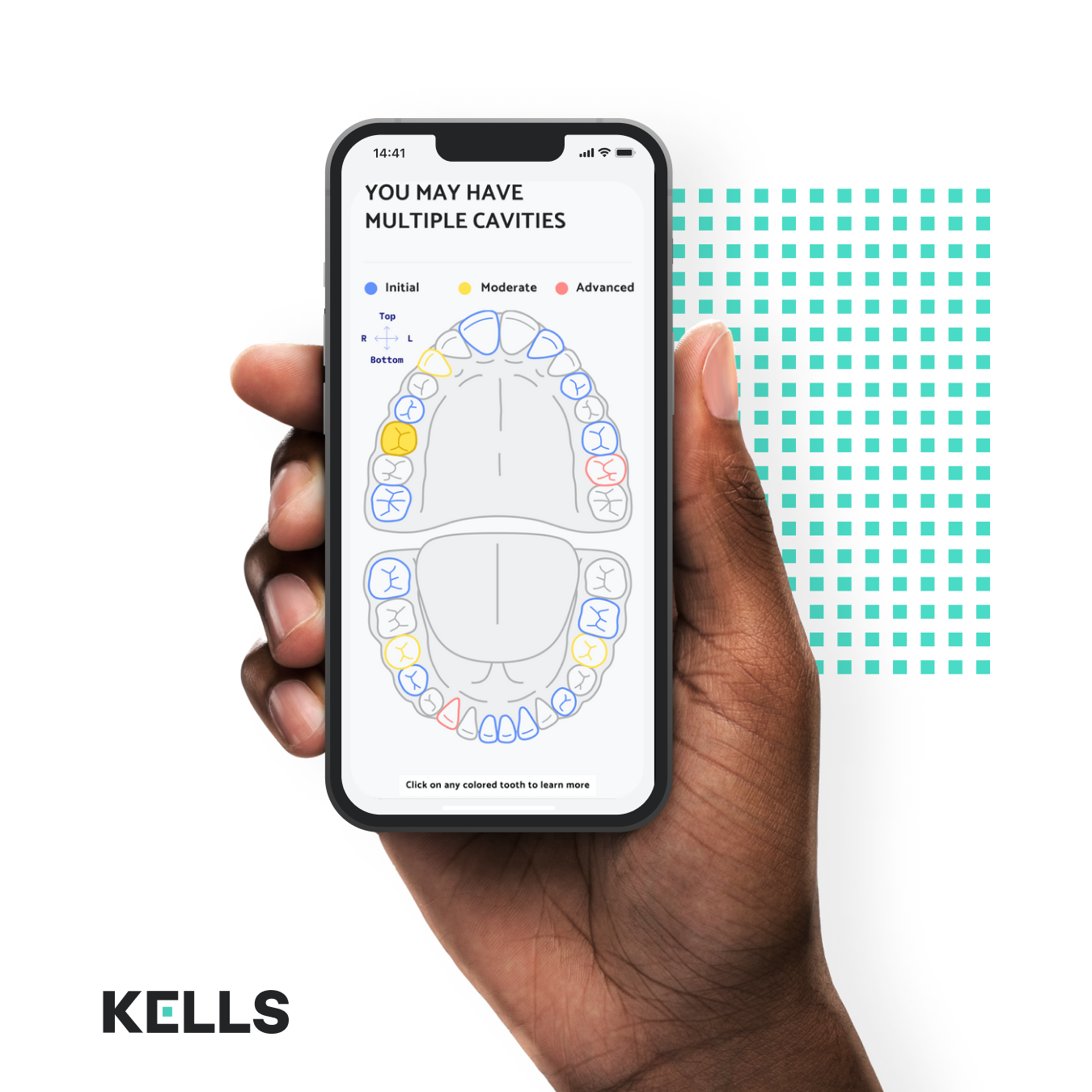 The Future of Oral Care: Why You Need an AI-Powered Dental Companion