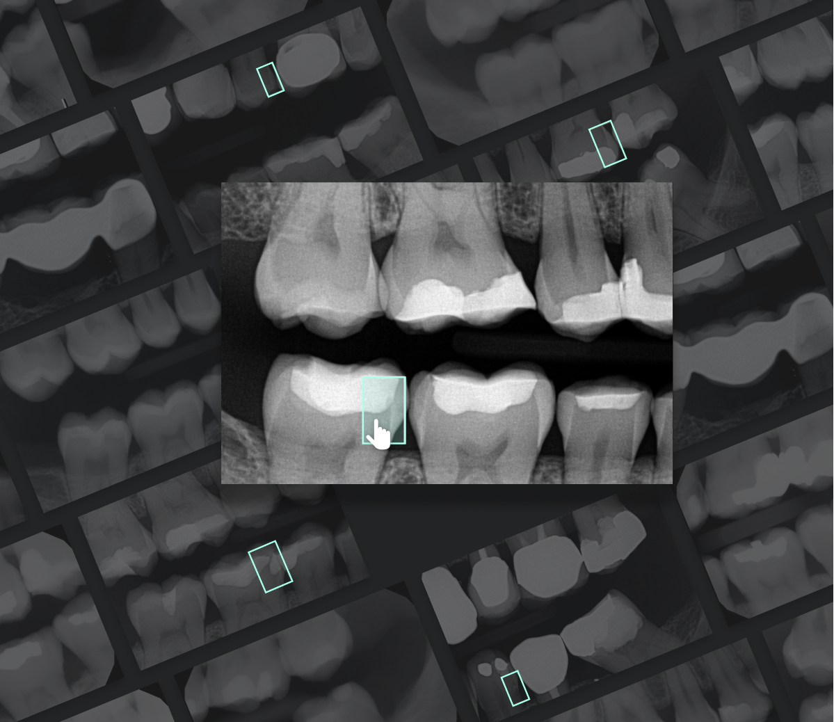 Use AI-powered Dental 2nd Opinion to fight over-treatments