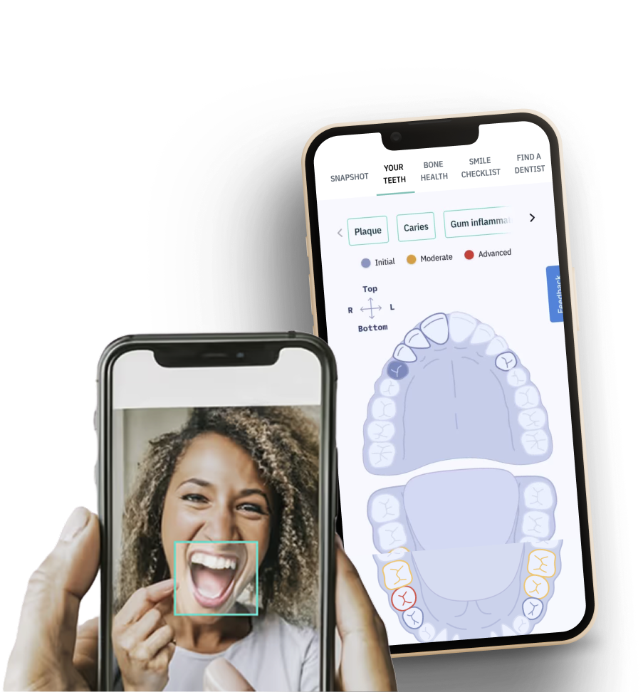 KELLS Virtual Checkup — AI-powered oral health report