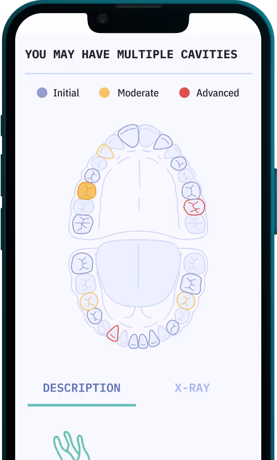 Get a personal dental report
